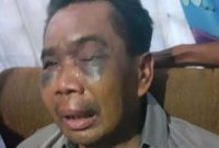 Sarpan, korban penyiksaan (Foto istimewa)