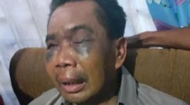 Sarpan, korban penyiksaan (Foto istimewa)