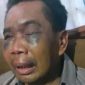 Sarpan, korban penyiksaan (Foto istimewa)